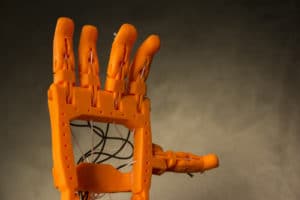 3D print prothese